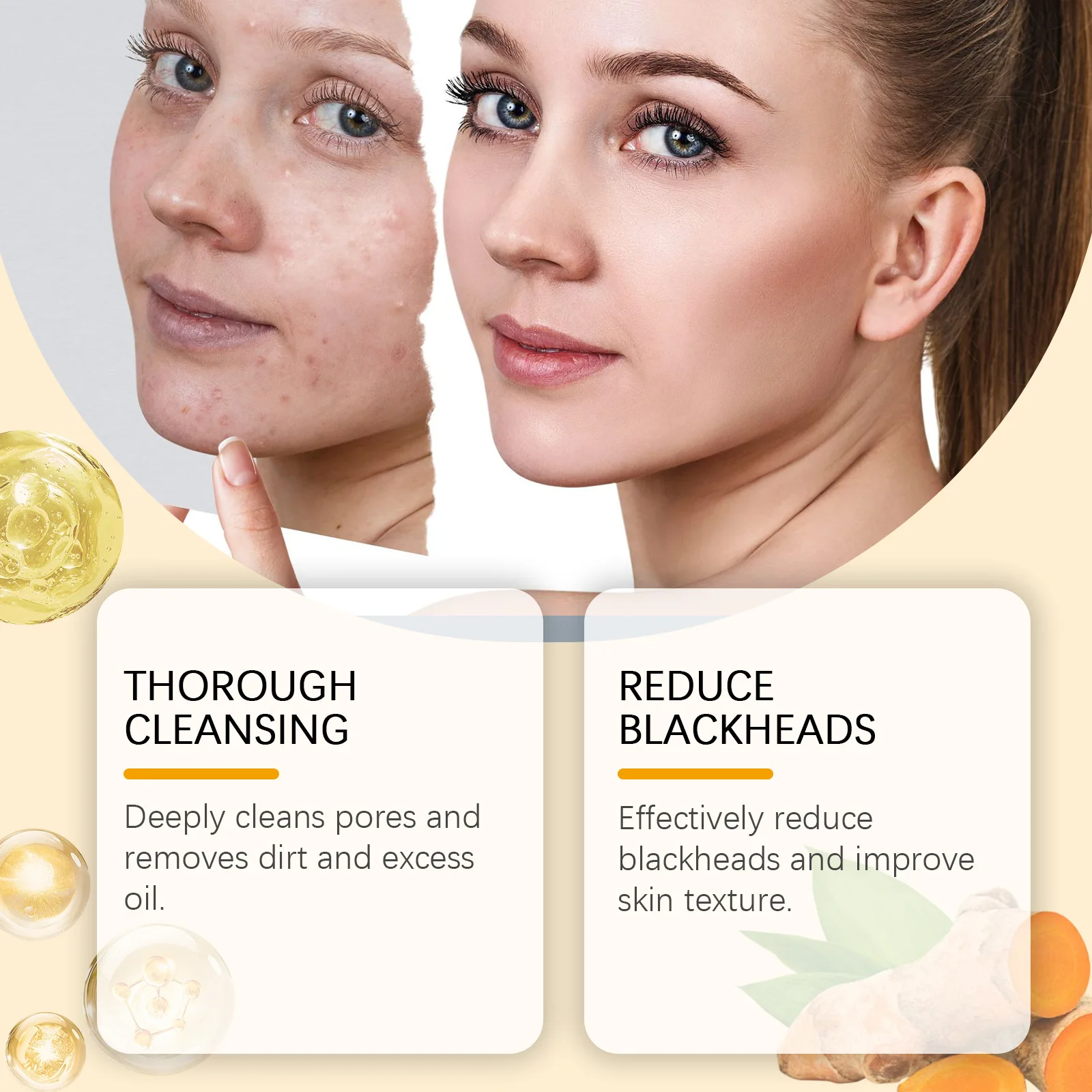 Turmeric Cleanser Deeply Cleansing Kojic Acid Blackhead Remover Skin Cleansing Oil Control Fade Acne Marks Brighten Foam Cleanse