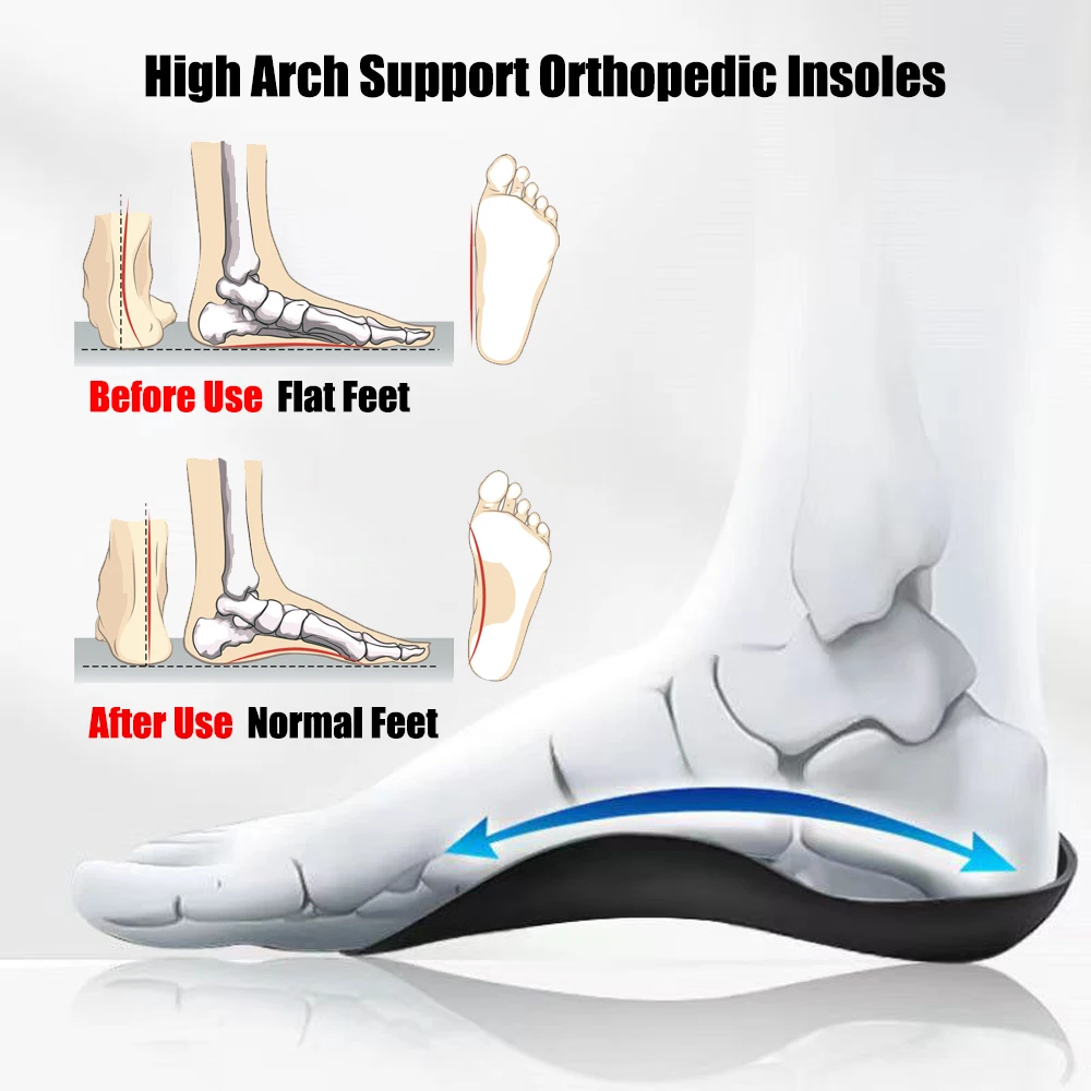 Orthopedic Insole for Flat Feet High Arch Support Insoles for