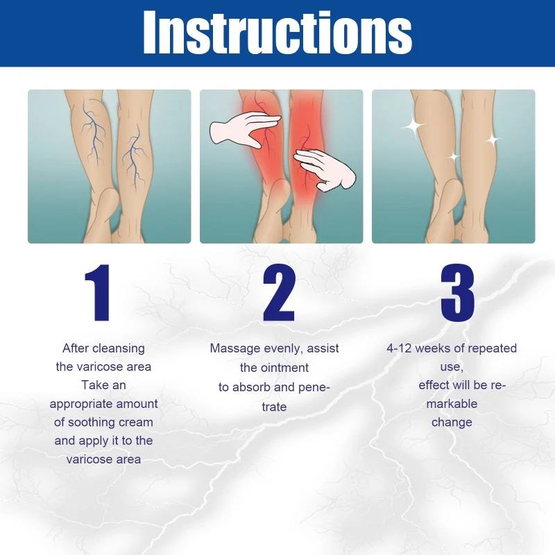Varicose Vein Repair Cream Tongmai Effective Relieves Leg Bulge Pain Treatment Cream Vasculitis Phlebitis Remove Vein 20g varicose vein ointment