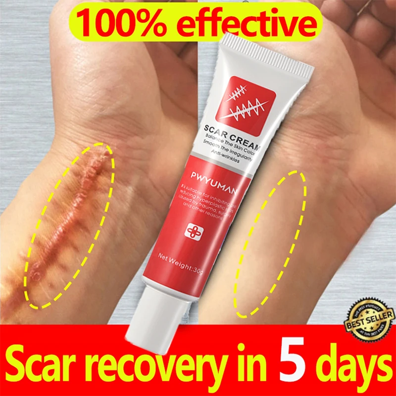 

Fast Scar Remove Cream Treatment Stretch Mark Burn Fade Acne Spots Section Scars Gel Whitening Repair Smooth Whitening Skin Care