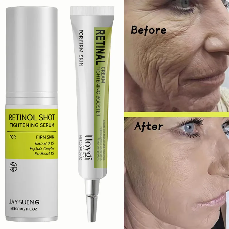 Retinolo Crema per la rimozione delle rughe Shot Rafforzamento Rassodante Linea sottile Enhancer Idratante Restringimento dei pori Riparazione Siero Set per la cura della pelle - immagine 3