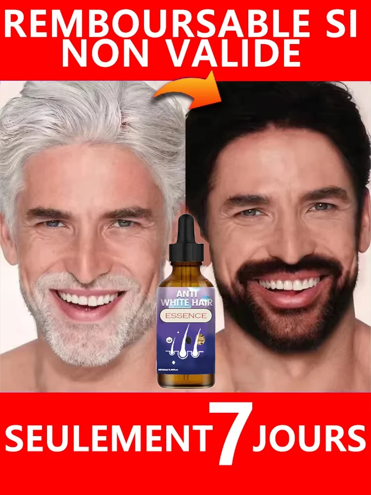 R&eacute;soudre les probl&egrave;mes de cheveux blancs &agrave; partir de la racine des cheveux pour restaurer la couleur naturelle des