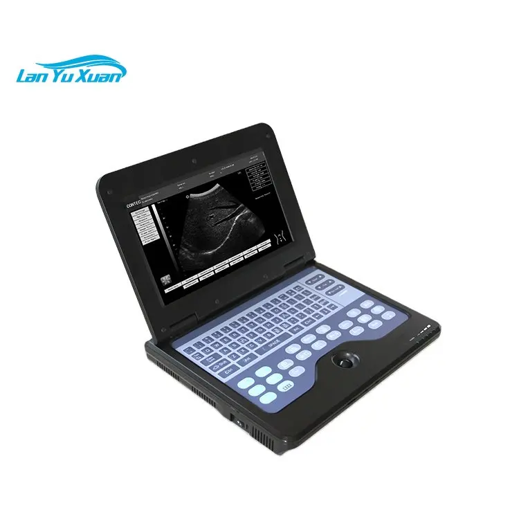 

CONTEC CMS600P2-VET Clinic Veterinary Instruments Names Ultrasound Veterinary Equipment China