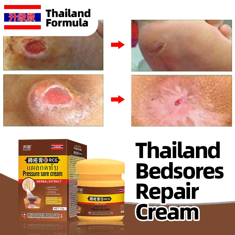 

Крем для лечения пролежней, язва от давления кожи, Лечение болей в кровати, удаление гниения, миогенная формула из Таиланда, медицина против пролежней