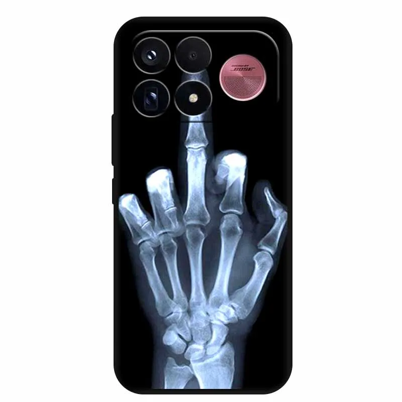 Lovely Cartoon Soft Silicone TPU Phone Case with Protective Bumper Cover