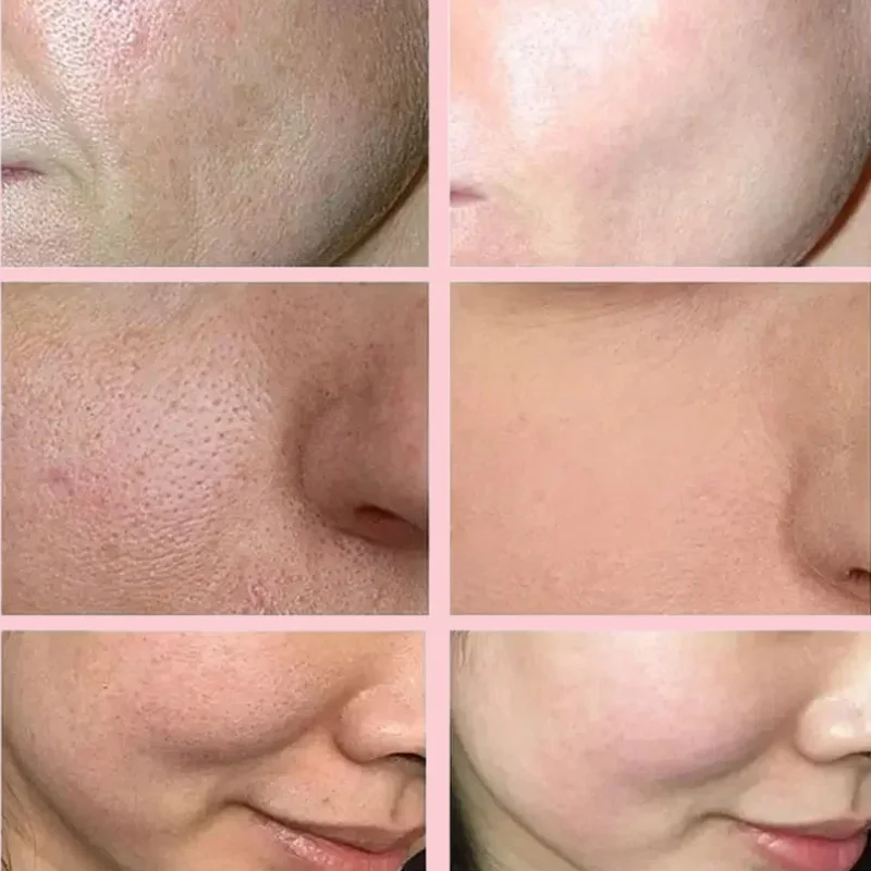 ساكورا تبييض كريم وجه ترطيب سطع مزيل التجاعيد تتلا...