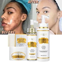 AILKE crème éclaircissante pour le corps, avec vitamine C, acide hyaluronique, beurre de karité, réduit les taches noires, même le teint, Lotion hydratante 1