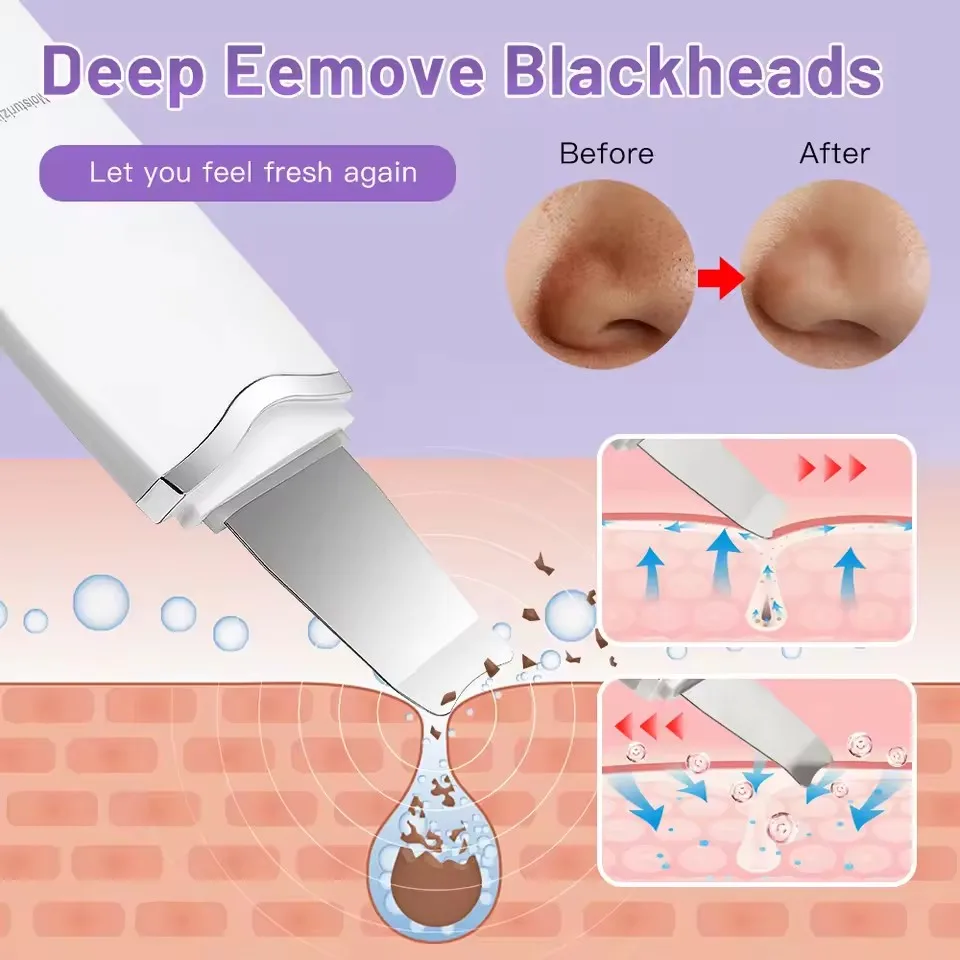 Ultrasonic Skin Scrubber Deep Cleaning Peeling Blackhead Remover Facial Shovel Cleanser Lifting Ultrasonic Ion Ance Pore Cleaner