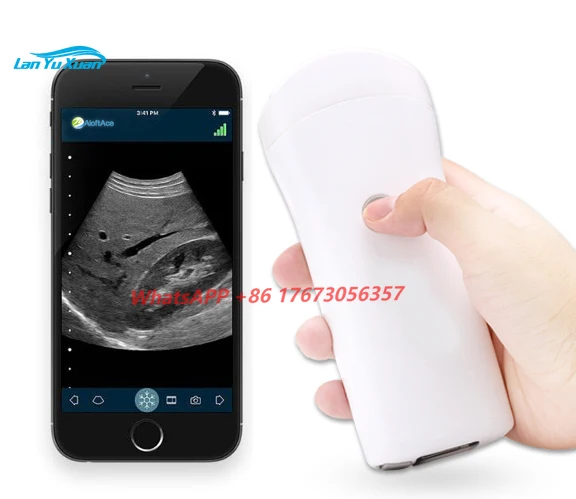 

Portable Mini USG Wifi Smartphone Wireless Ultrasound Probe For Android, IOS,Windows