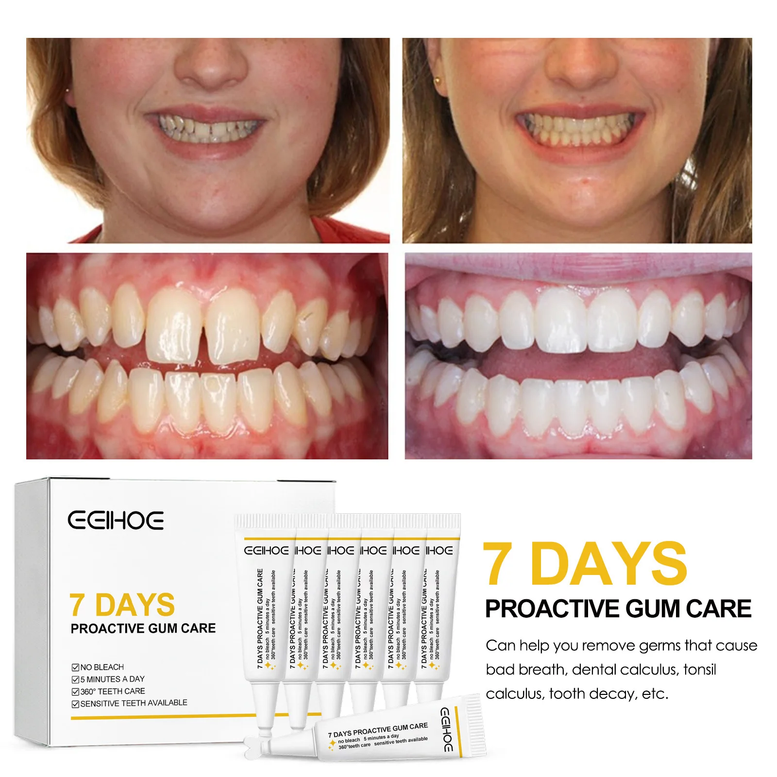 7 Days Rapid Repair Gums Serum Instant Soothing Gel Gum Repair Artifact Relieve Tooth Allergy Dental Caries Cleaning Toothpaste