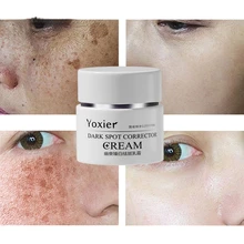 

Remove Spots Body Pigmentation Face Cream Effective Dark Spot Correction Cream Women Ladies Whitening Brightening Skin Care