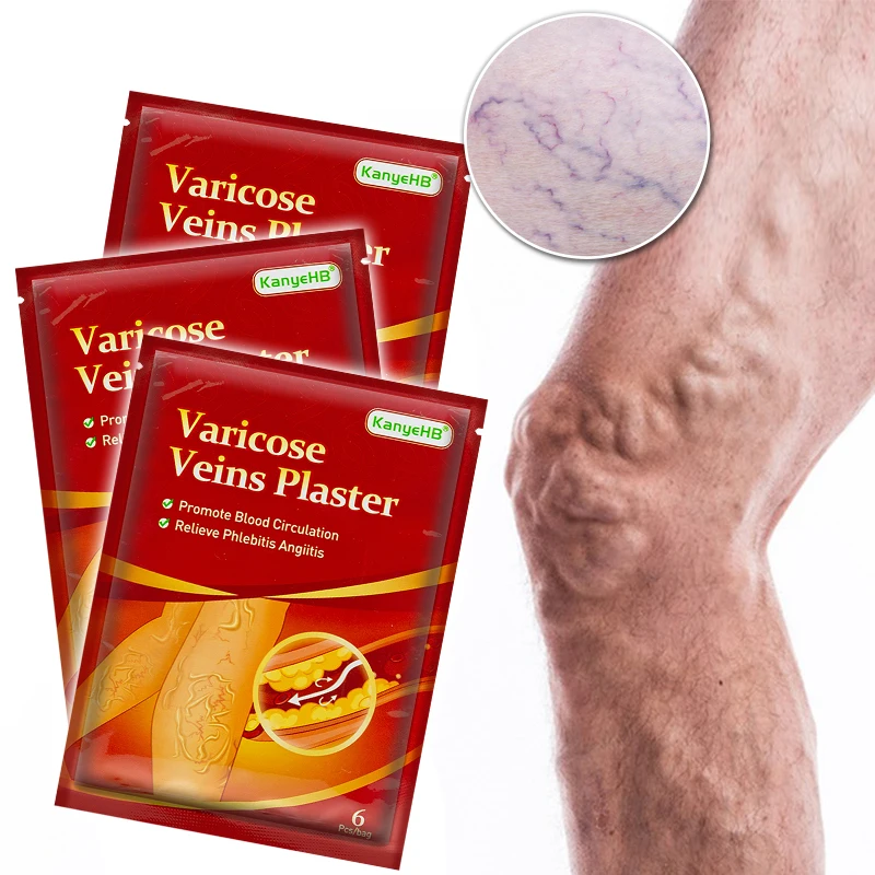 

18pcs=3bags Varicosity Herbal Patch Varicose Veins Plaster For Legs Venous Swelling Relief Stickers Vasculitis Phlebitis A594