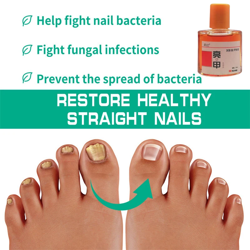

25ml Nail Fungal Care Liquid Onychomycosis Repair Essence Toe Nail Fungus Removal Solution Anti Infection Paronychia Dressing