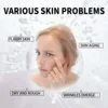5ML/15ML/30ML/50ML/  TRSTAY  Nicotinamide (B3)  Facial serum  Using vitamin E+penetration  Hyaluronic acid  Accelerate collagen 5