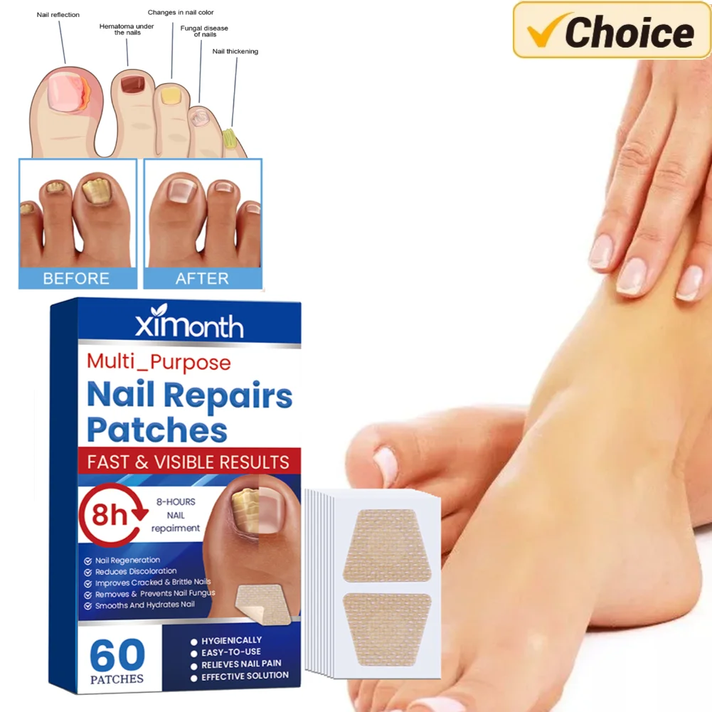 60Pcs/Box Toenail Fungus Patch Nail Repair Patches Ingrown Toenail Correction Stickers Foot Care Tools