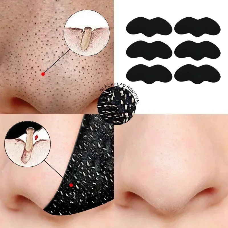 10-50PCS Nose Blackhead Remover Mask Shrink Pore Acne Treatment Sticker Black Dots Strips Nose Deep Cleansing Cleaner Skin Care 2