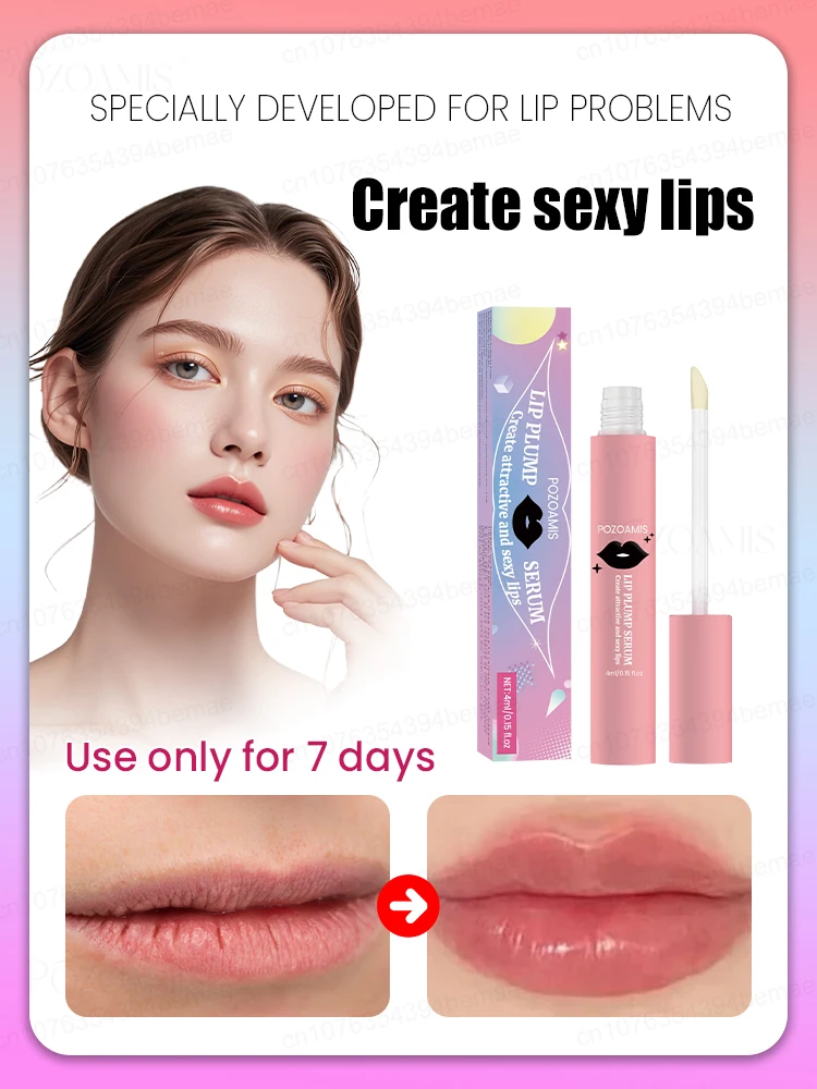 Lip Augmentation in one month