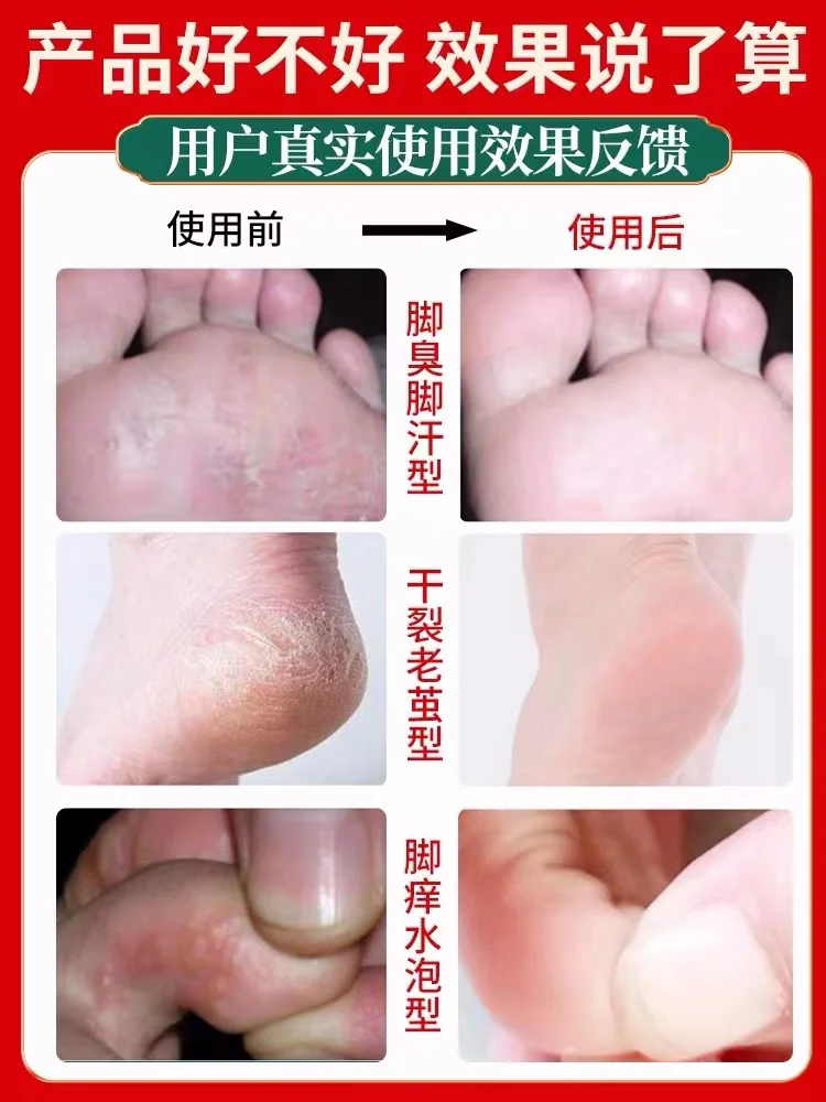 1600g Beriberi Powder Foot Sweat Soak Foot Medicine Pack SPA Deodorization Treatment Itching Blister Peeling Care