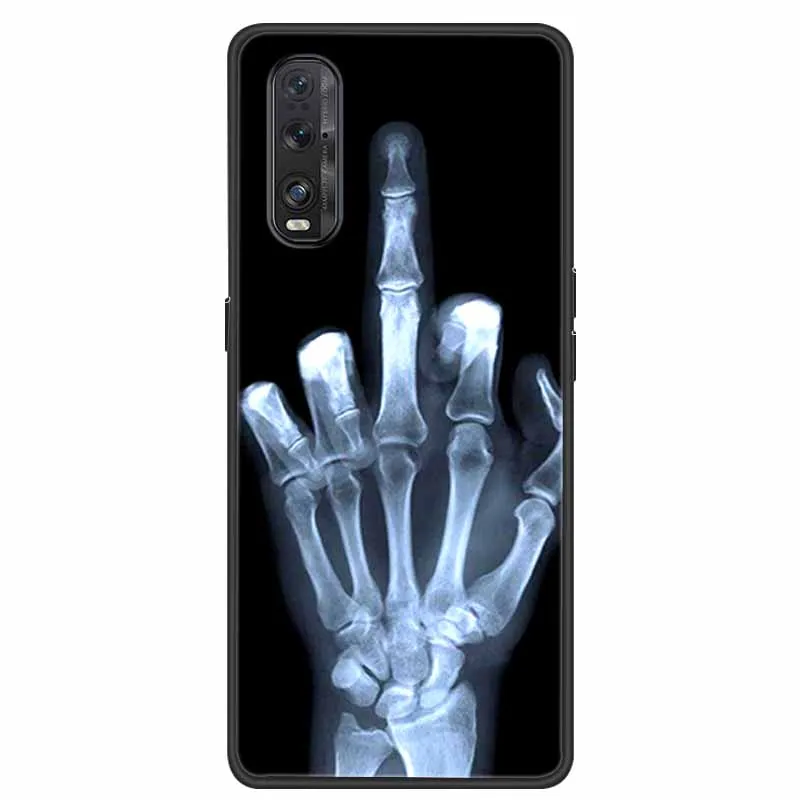 Stylish Marble Soft TPU Silicone Phone Case
