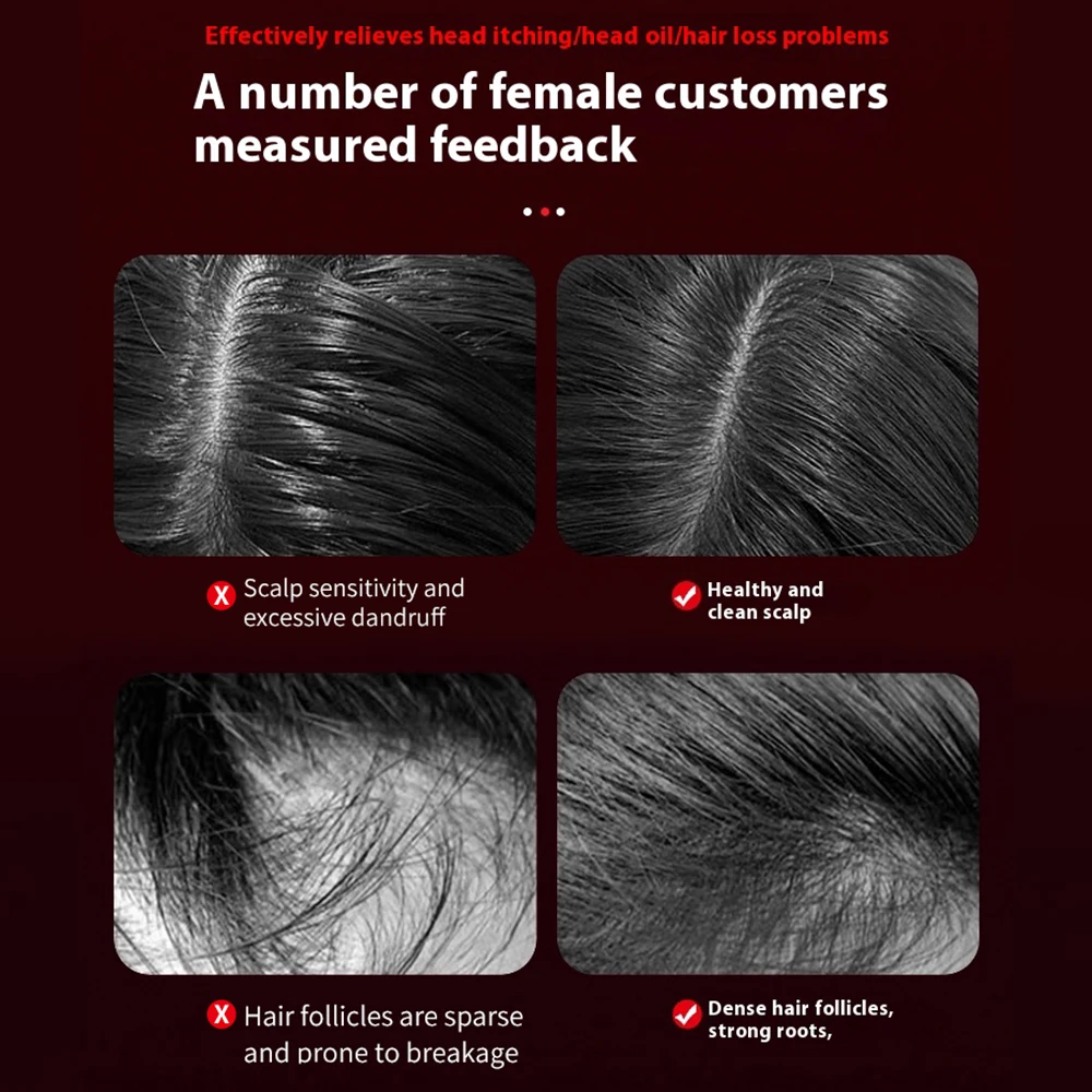 Electric Massage Comb 3 Modes Portable Red Light Laser Comb for Hair Follicle Hair Follicles On The Head Essence Oil Applicator