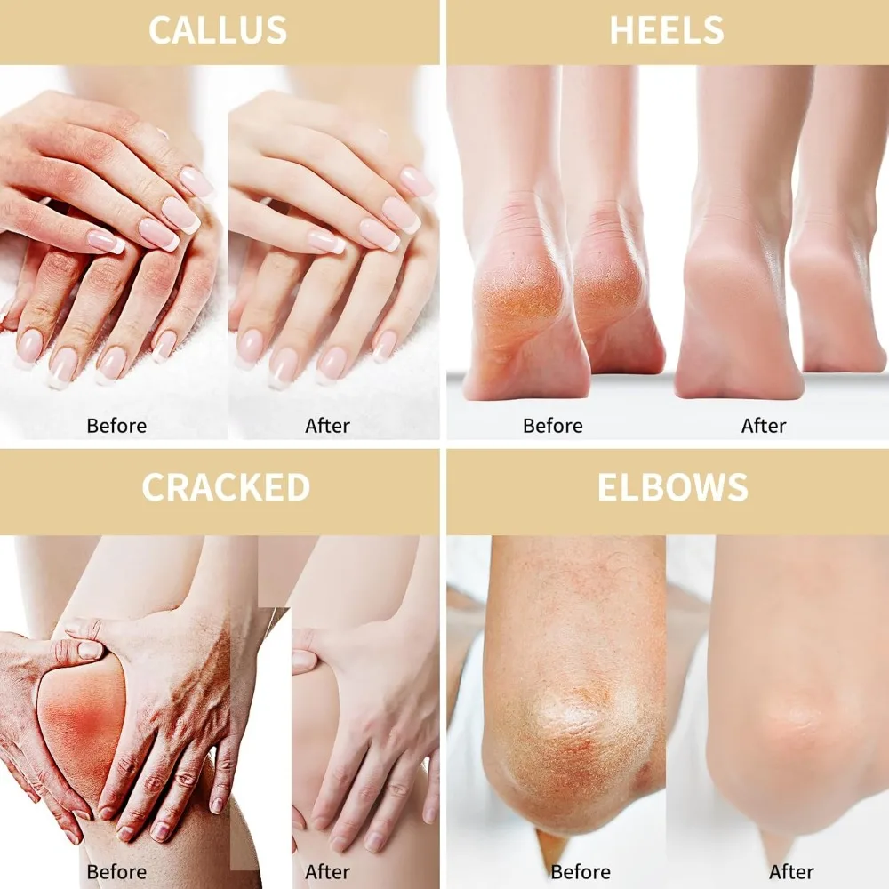 50% Oat 2% Salicylic Acid 2.76inch Urea Moisturizing Cream Tea Tree Aloe Vera Moisturizing Cream Hyaluronic Acid Oatmeal