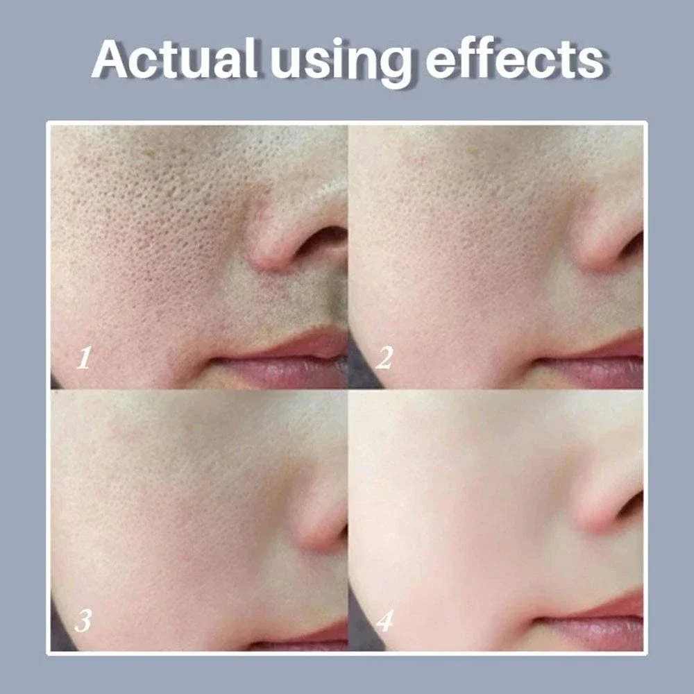 Skin Texture | Pore Refining Resurfacing, Brightening Facial Serum with Retinol and Niacinamide Non-Comedogenic 4