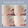 Skin Texture | Pore Refining Resurfacing, Brightening Facial Serum with Retinol and Niacinamide Non-Comedogenic 4