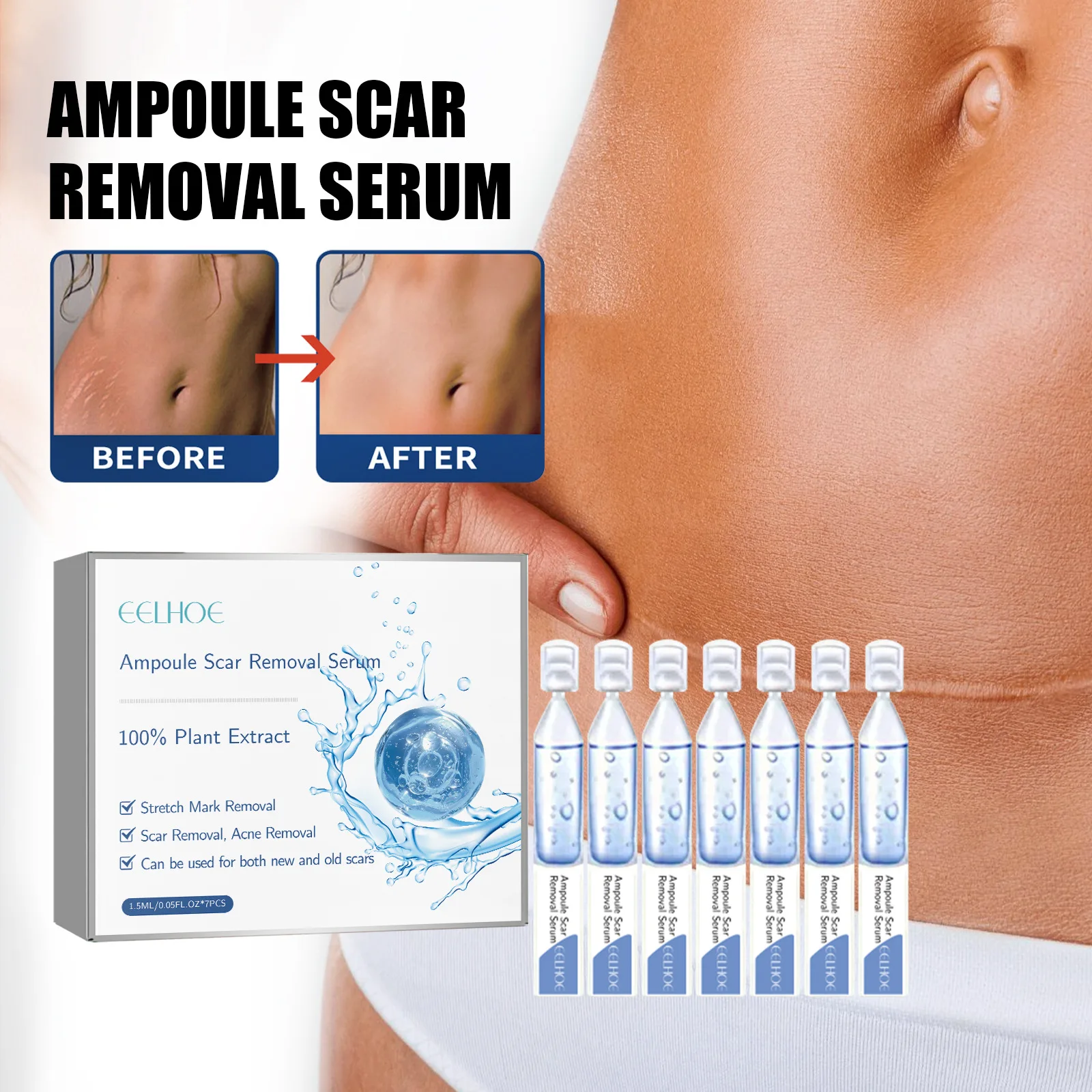 Stretch Mark Removal Essential Oil Pregnancy Lift Maternity Repair Fade Cesarean Section Scald Burn Surgical Scar Health Care