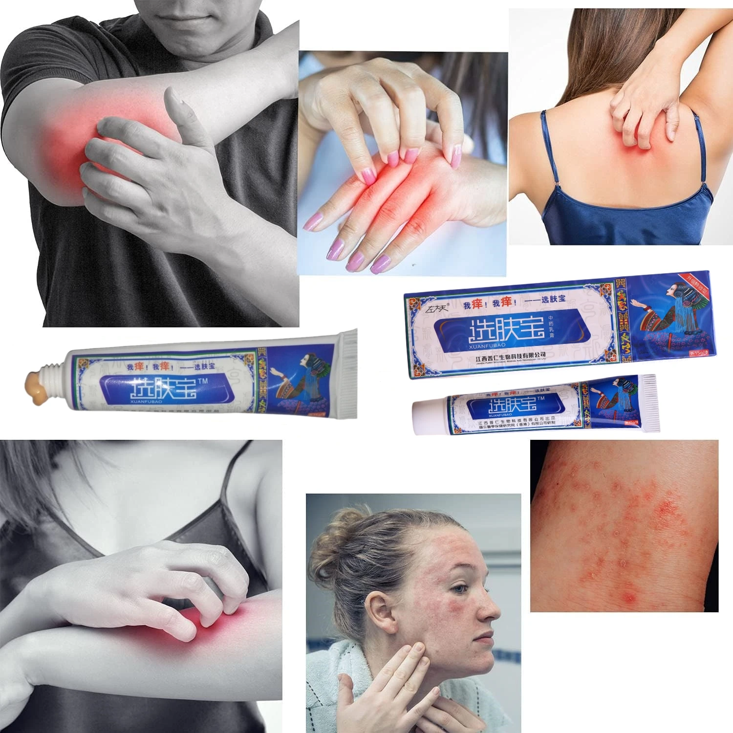 Natural Chinese Herbal Eczema Psoriasis Cream Dermatitis And Eczema Pruritus Psoriasis Ointment Healthy Skin Care
