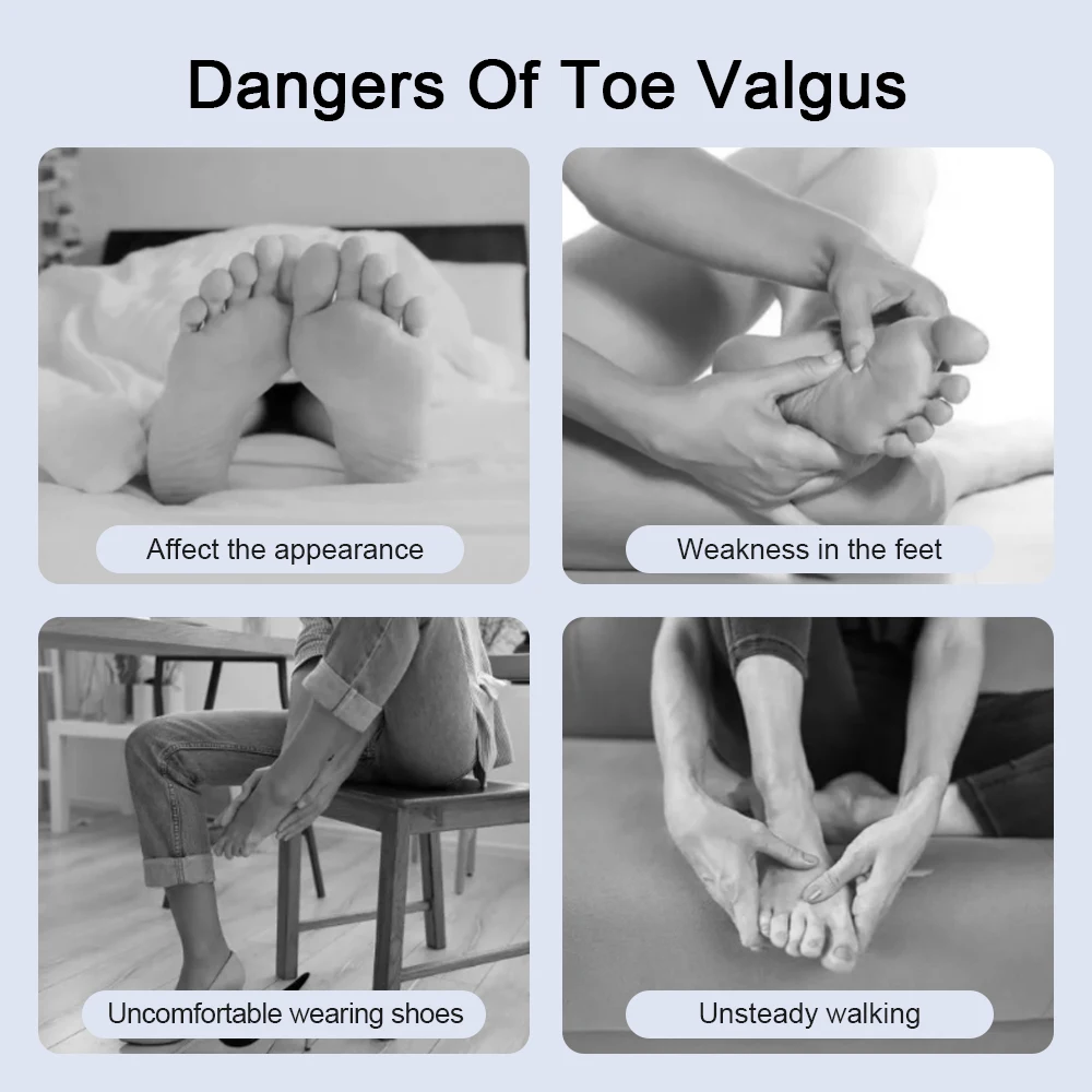 Adjustable Bunion Splint Corrector Big Toe Straightener Foot Hallux Valgus Braces Orthopedic Supplies Pedicure Correct Foot Bone 8 Adjustable Bunion Splint Corrector Big Toe Straightener Foot Hallux Valgus Braces Orthopedic Supplies Pedicure Correct Foot Bone 3