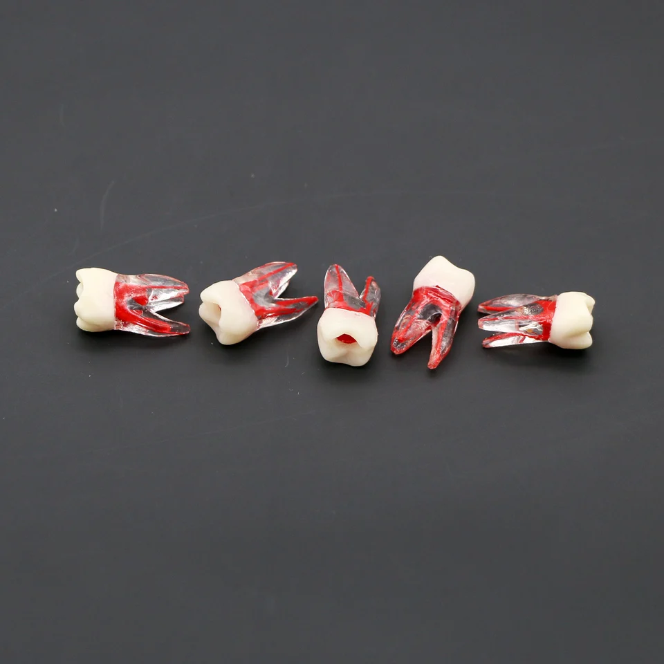 Odontoiatria Conservativa - Studio Dentistico Gervasoni Ghislanzoni - Foto 5