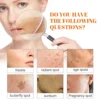 Skin Lightening Serum Strong Shades Dark Skin Anti Age .Extreme Whitening Cream for DARK Skin Face skin care products 5