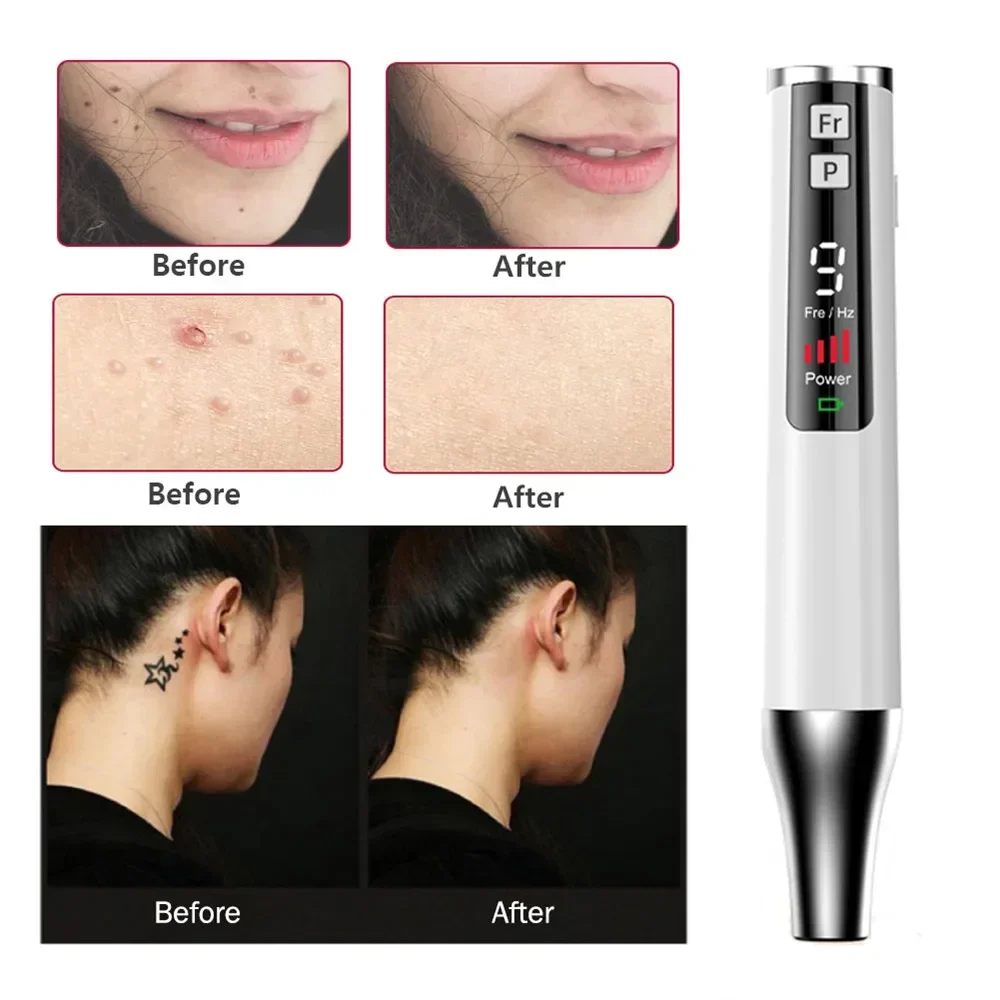 9 Level Laser Pen Tattoo Remove Mole Freckle Scar Removal Blue Light Therapy Dark Spot Pigment Removal Beauty Skin Instrument