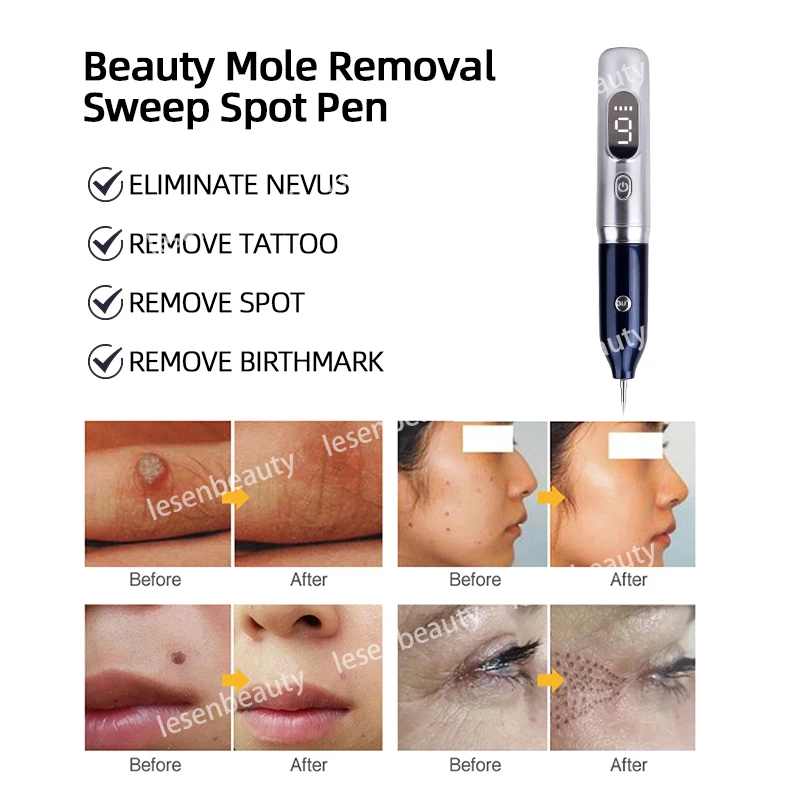 Laser Plasma Pen Black Dots LCD Plasma Pen Professional Facial Care Beauty Equipment USB Rechargeable Papilloma Skin Tag Removal