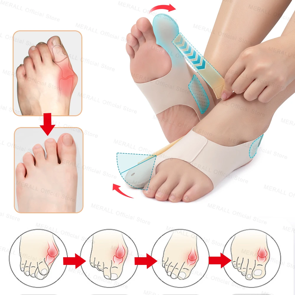 Toe Separators Toe Corrector Toe Protector Big Toe Bunion Corrector Adjustable Orthopedic Socks Hallux Valgus Feet Protector Foot Care Tools
