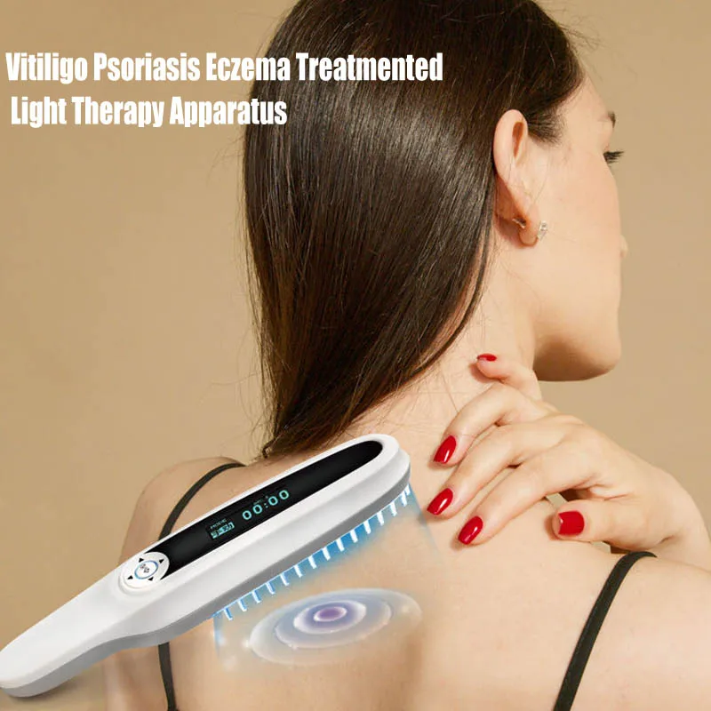 백반증 치료용 UVB 건선 기계, 협대역 광 치료 기기, 병원 등급 가정용 기기, 311nm, 308nm 