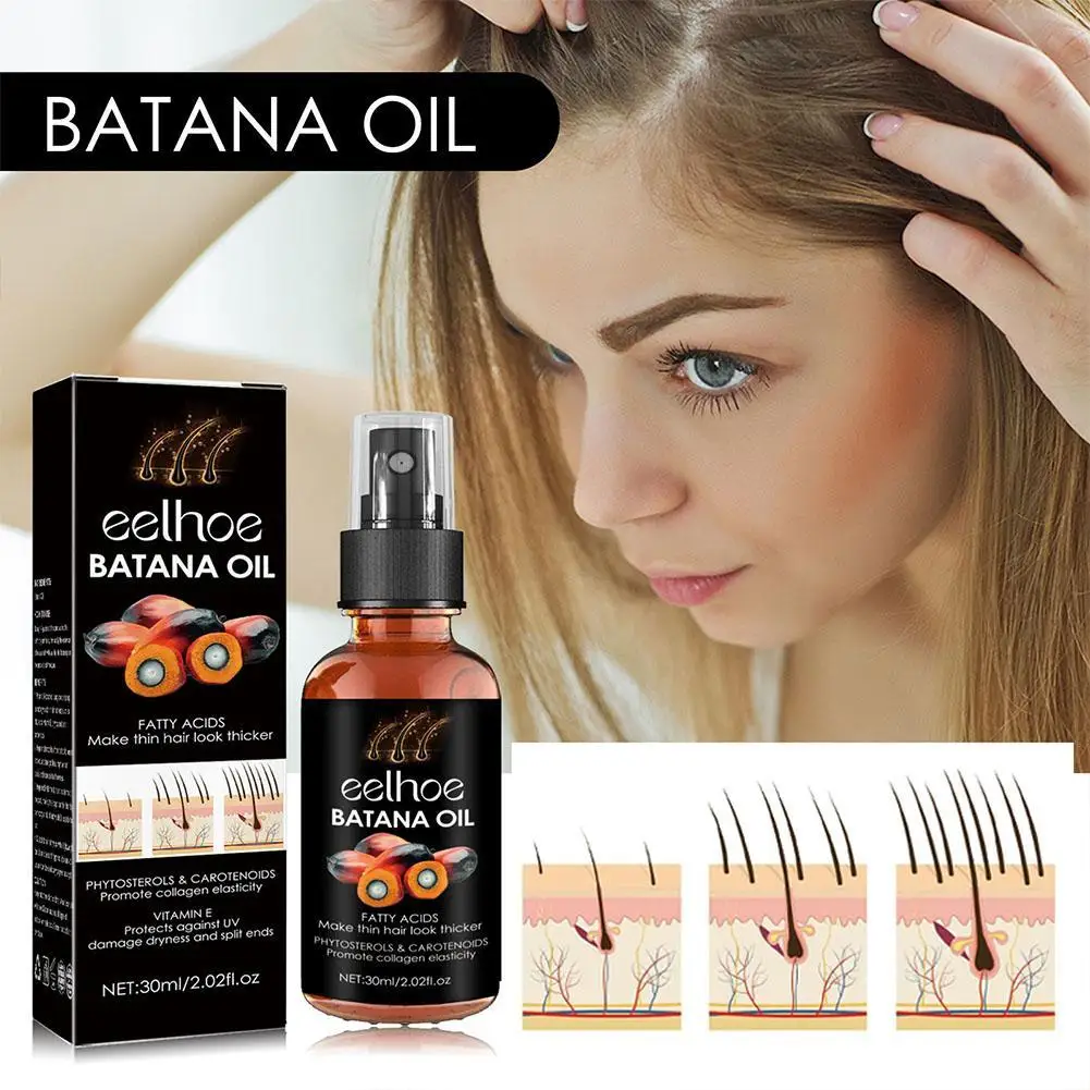 

Batana Oil Products Fast Hair Growing Spray Hair Loss Treatment Oil Beauty Health Hair Care for Men Women 30ml