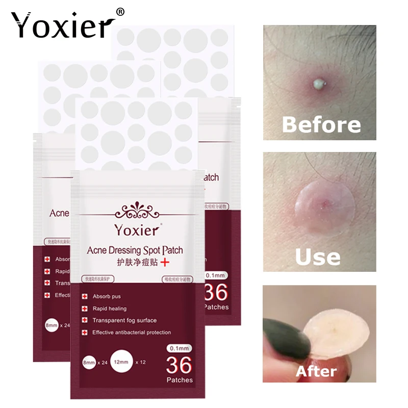 

Facial Acne Spot Care Treatment Sticker Anti Infection Invisible Waterproof Oil Control Beauty Skin Care Tool For Men Women 3pcs