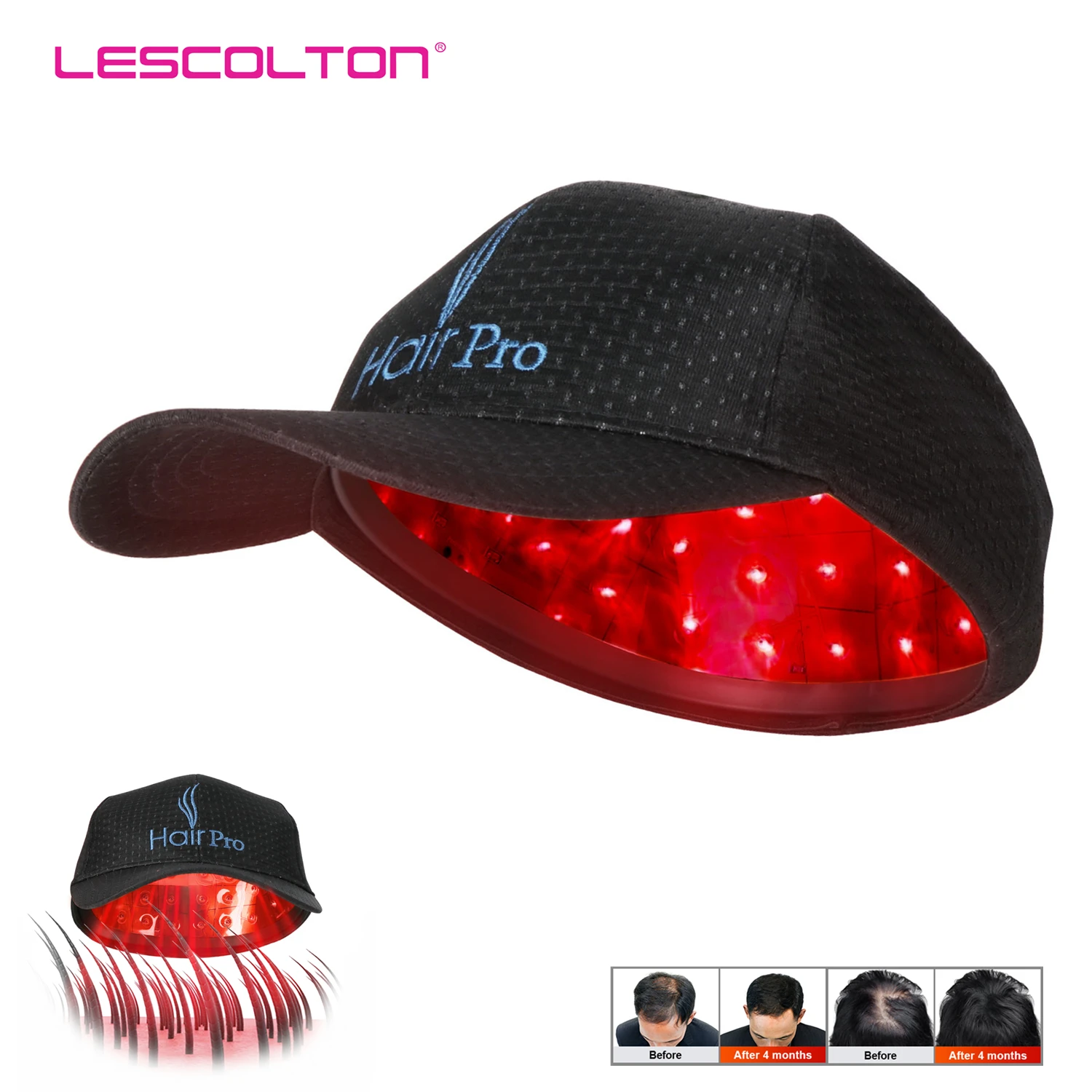 Laser Hair Growth Cap Lllt Therapy 81 Diodes Anti Hair Loss Treatment  Promote Hair Regrowth Device Hair Restore Product Man - Hair Growth Devices  - AliExpress