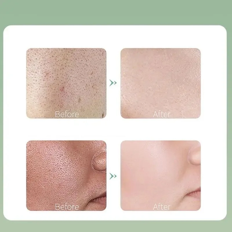 3boxes Bubble Face Mask Masque Centella Asiatica Purifying Foam Mud Hydrating Moisturizing Oil Control Anti Shrink Pores Cleans