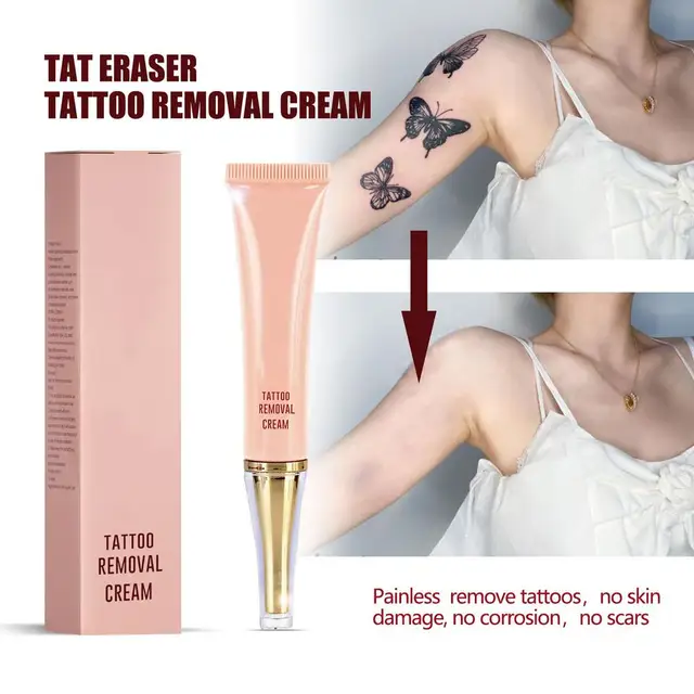 Share more than 68 ink eraser tattoo removal