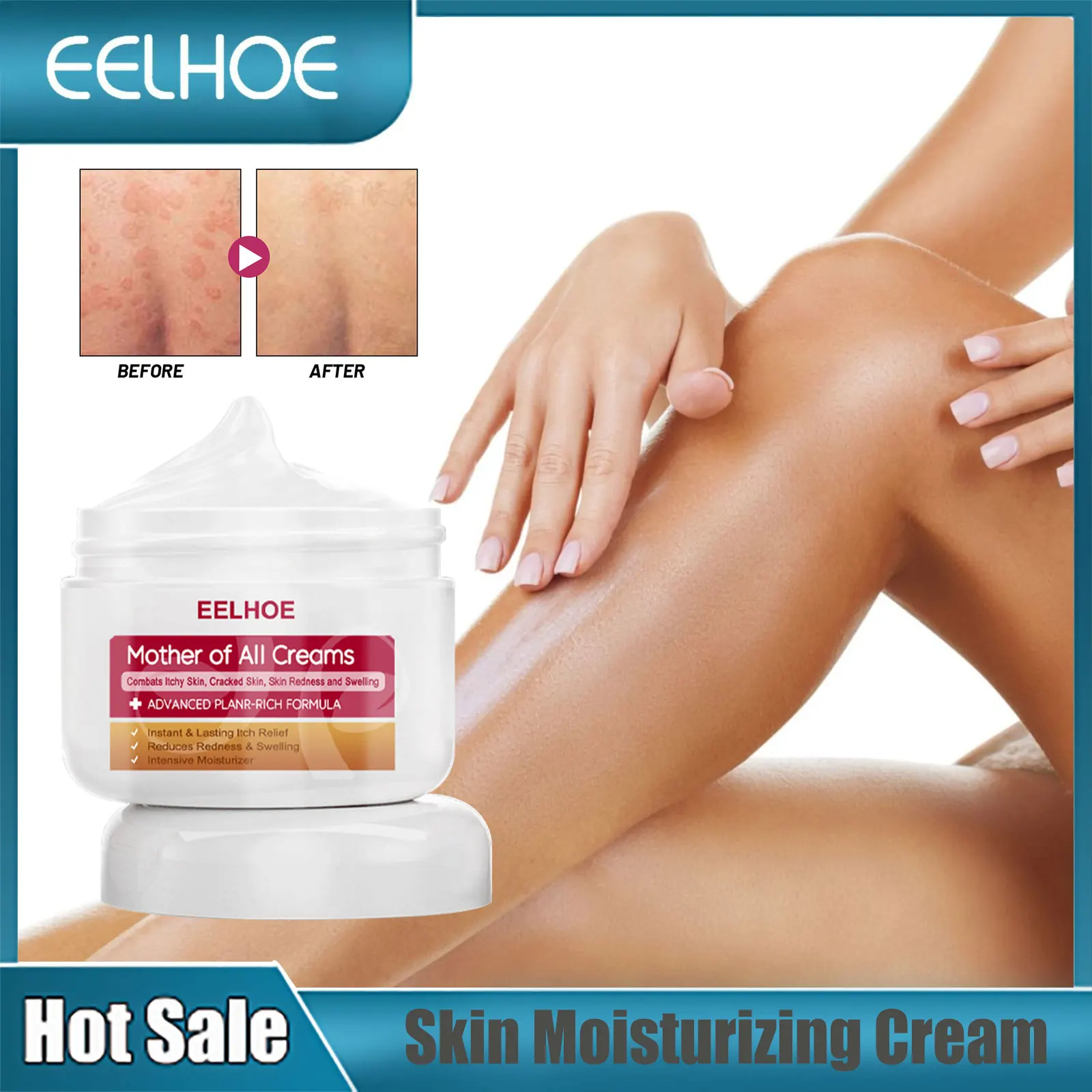 EELHOE Anti Itch Cream Skin Nourishing Cracked Heels Moisturizers Anti-Aging Dry Skin Care Anti Cracking Skin Repair Cream 50g