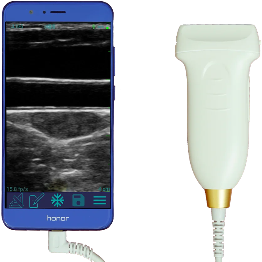 

Digital 2D Portable Wireless Ultrasound USB Probe Transducer Tablet For Vascular, Anesthesia, Small parts, MSK