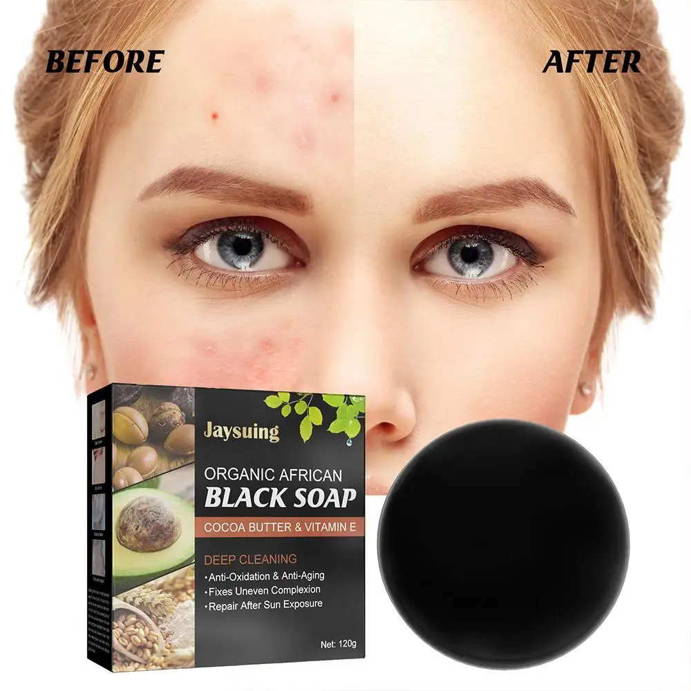 

African Black Soap Treatment Acne Handmade Anti Rebelles Smooth Blemish Shea Butter Face Moisturizing Gently Bath Skin Care 100g