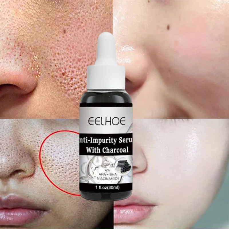 Charcoal Facial Deep Cleaning Whitening Serum Shrink Pore Anti-Acne AHA BHA Nicotinamide Exfoliating Acne Peeling Solution