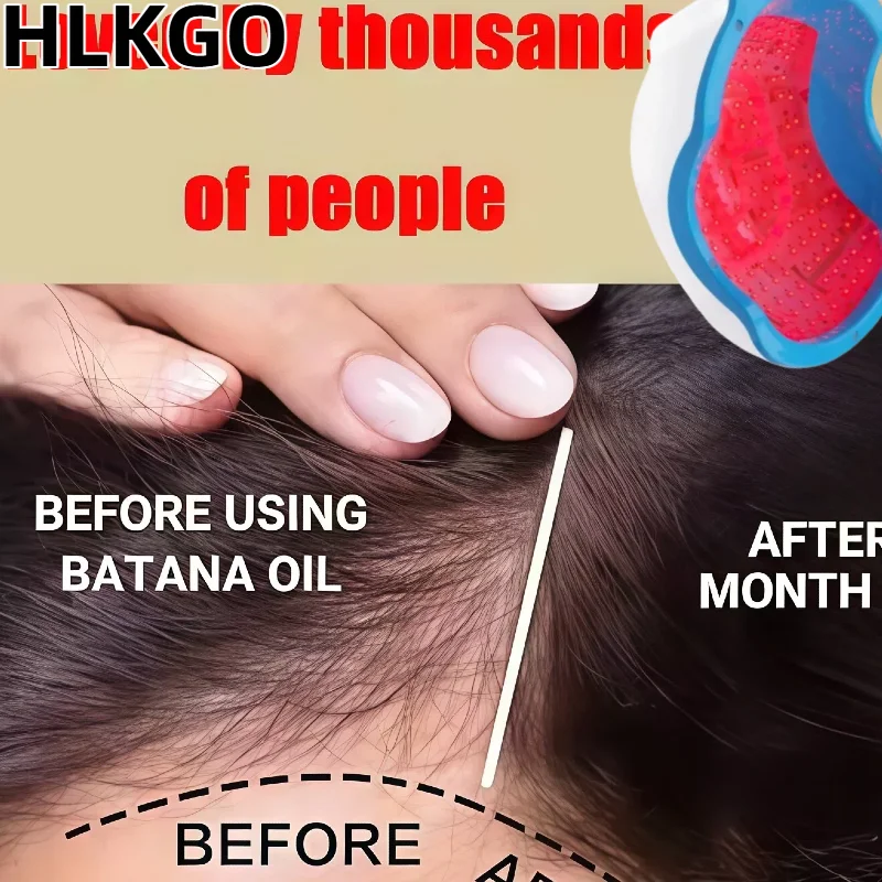 665nm Near-infrared Hair Growth Cap 80Pcs, Red Light Therapy for Anti-Hair Loss, Reduces Oiliness and Strengthens Roots