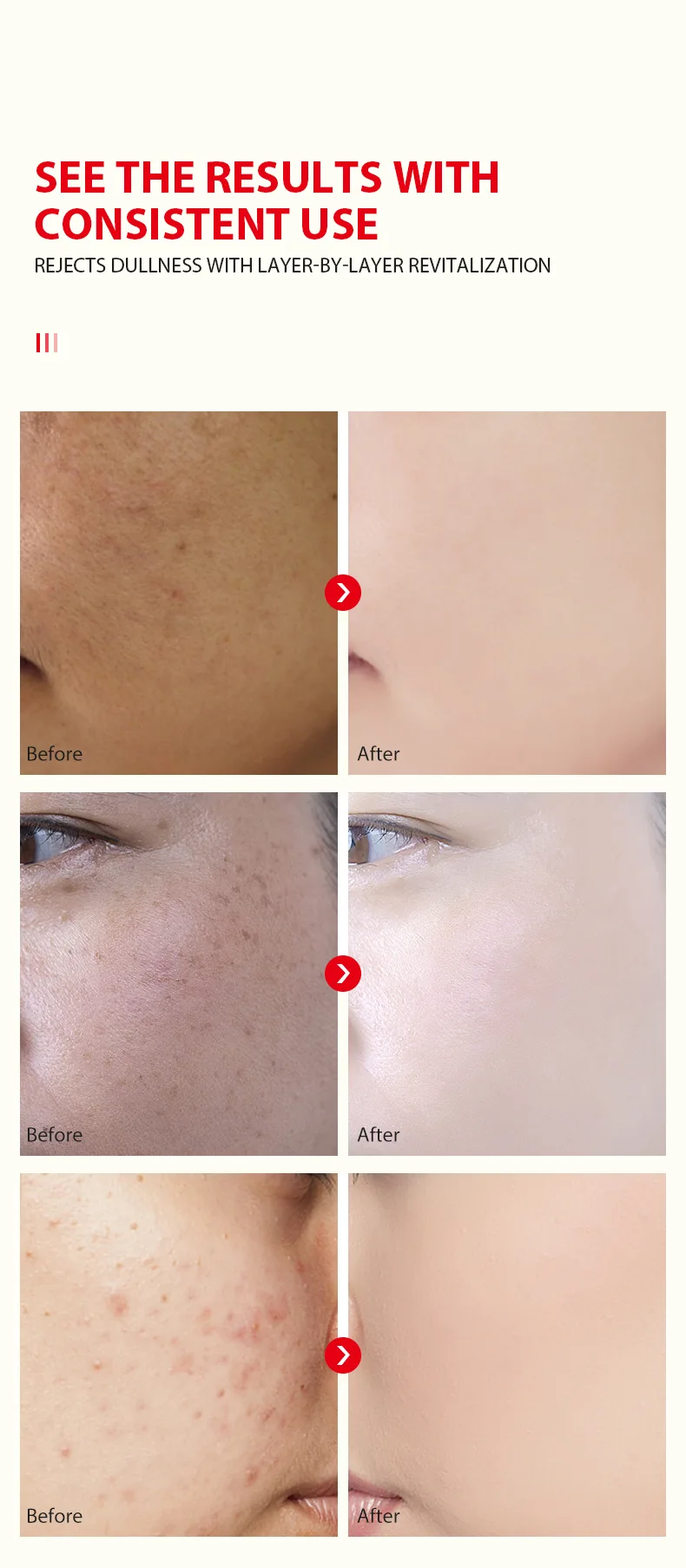 Kojic Acid Face Whitening Serum Glutathion Remove Blemish Dark Spot Correcting Glow Serum Face Skin Care Moisturizer Cosmetics 6