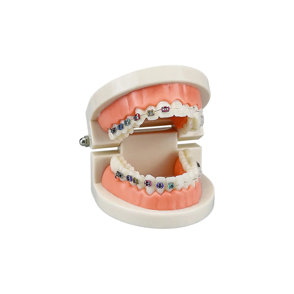 Orthodontics Model with Ceramic and Metal Brackets Teach Model