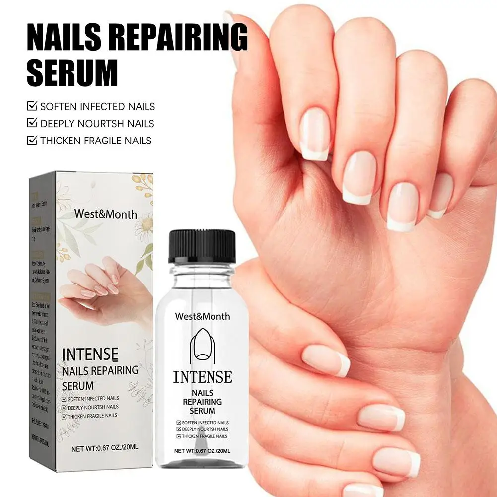 

Intense Nail Growth And Strengthening Serum 7 Days Nail Growth And Strengthening Serum Nail Strengthener For Thin Nails And Q0U6