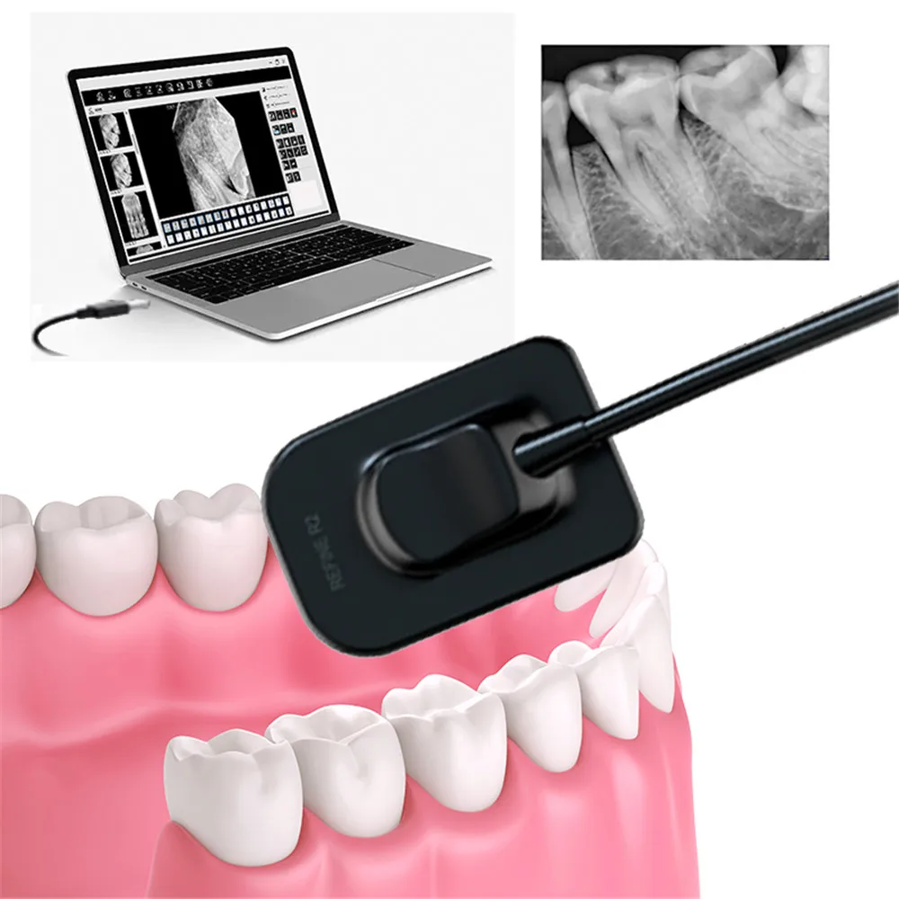 Price Intraoral Digital X ray ECO Sensor II With Holders Dental Imaging System RVG Sensor for